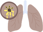 Chronic Diseases